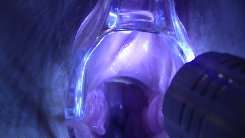 adult critical care drip concentrations administration