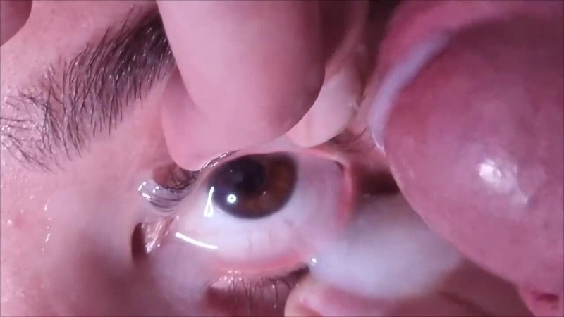 canine anal sac fistula treatment ft. Zandy Peterzon — free porn video (14:41)